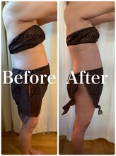 小顔屋ゆらやぎ/