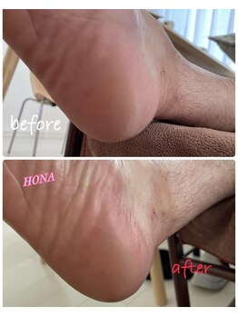 ホナ(HONA)/メンズにも人気!