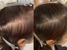 特典あり☆【5回コース】プロセルセラピーズ最速育毛促進プログラム　¥200000