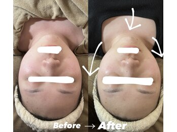 ラ ブリエ(La Briller)/小顔+ハーブ+プラズマ照射