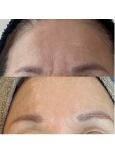 ザ アールアール(THE RR)/ゾンビパックの威力！２