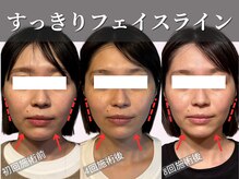 フレキシボディ(FlexiBody)の雰囲気（小顔になるの諦めてませんか？Minoruの小顔矯正整体にお任せ！）