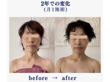 シンシア(sincere)/別人に変わる、sincereのコルギ