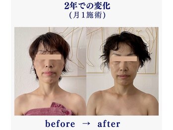 シンシア(sincere)/別人に変わる、sincereのコルギ