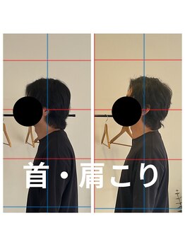 熊本カワル整体 JR上熊本駅院/首、肩の痛み