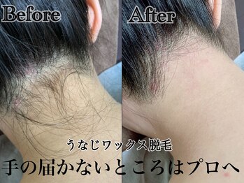 アンドエス 六本木(and S.)/美うなじはプロにお任せ☆