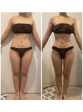 ヴィクシア(VIXIA)/痩身90分