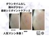 本気ホワイトニングペンシル取り放題＋ヒト幹細胞導入＋美白パック3回　