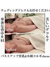 クラルス(clarus)/ビフォーアフターの違いに驚き！