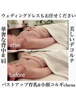 クラルス(clarus)/ビフォーアフターの違いに驚き!
