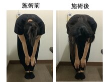 だるま整骨院/始めての矯正後の変化