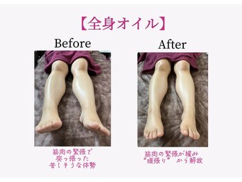 ハナコ by ほぐしの名人 弁天インター店(HANAKO)/