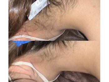 プリマ(Prima)/BEFORE&AFTER