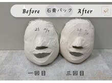 ロト(Roto)/石膏パックBefore→After