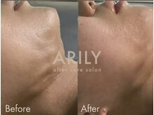 アリリィ(ARILY)/ARILY after care salon