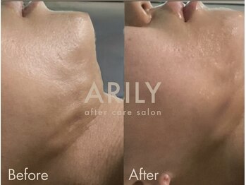 アリリィ(ARILY)/ARILY after care salon