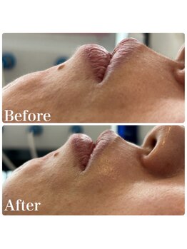 エルドットサナ(L.sana)/フェイシャルワックス