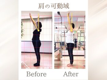 ラ ピラティス 銀座店(La pilates)/慢性的な肩こりに