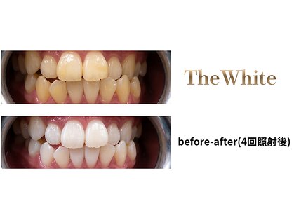 【ホワイトニング専門サロン】The White【10/10 NEW OPEN(予定)】の写真