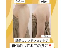 ザ サロン 726(THE SALON 726)の雰囲気（スッキリ毛穴/小顔も叶える☆レモンボトルRedShotキャンペーン中）