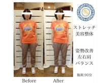 RKY/肩の左右バランス改善