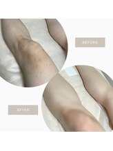 オフオルファヴォリ(OF Olu:Favori)/【フラッシュワックス脱毛】