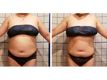 フェリシテ(Felicite)/ビフォーアフター