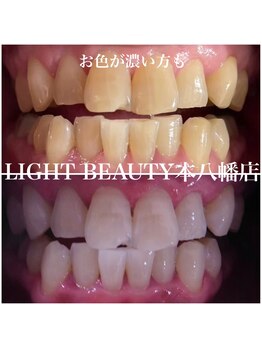ライトビューティー 本八幡店(LIGHT BEAUTY)/お色が濃い方もご心配なく♪