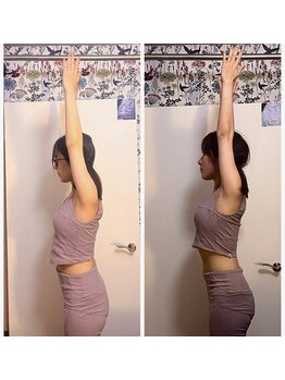 サロン ド ピラティス ラワンデル(salon de pilates)/姿勢改善モニター