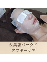 エクラ(eclat)/アフターケアで鎮静　