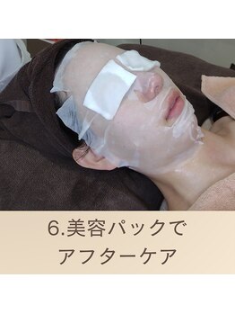 エクラ(eclat)/アフターケアで鎮静　