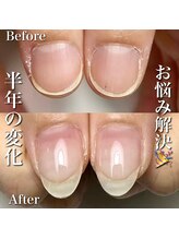 リリー/隠してしまう親指もこの変化！