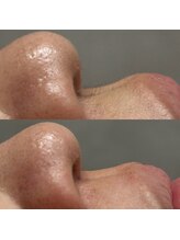 エルドットサナ(L.sana)/フェイシャルワックス