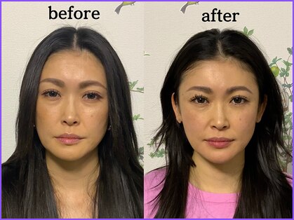 ハリカフェ(HARI CAFE)の写真