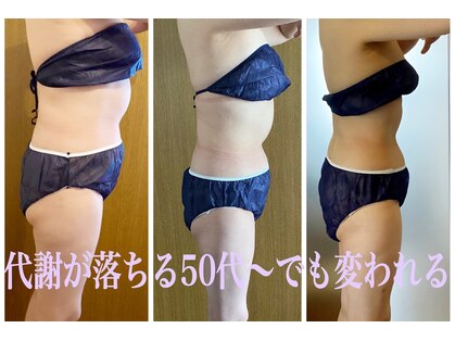 アリス 赤坂の写真