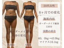 サロン ド ボーテ ラーンジュ 岐阜店(salon de beaut'e L'ange)/ハイパ-ナイフEX2ダイエット痩身