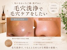 ステラ グランデ 福岡博多の雰囲気（毛穴洗浄で頑固な汚れを一掃。小顔&毛穴のWケアでスッキリ爽快♪）