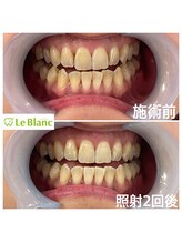 ルブラン 奈良店(Le Blanc)/お姉さ様のご紹介でスタート！