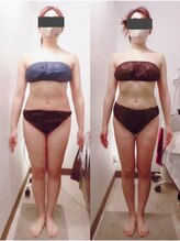 グレイスボディ BiViつくば店(Grace Body)/◆痩身　症例写真