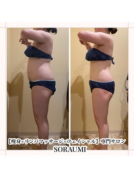 ソラウミ(SORAUMI)/Before→After6回