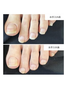 ネイルアトリエ ボン(nail atelier bon)/フットネイルケア