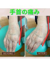 永田東洋鍼灸整骨院/鍼灸と超音波で痛みの解消を☆彡