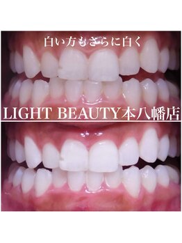 ライトビューティー 本八幡店(LIGHT BEAUTY)/白い歯の方のメンテナンス！