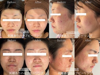 ライフサロン 天神(Life Salon)の写真