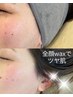 マリムーブフェイシャルwax+ホームケアパック付 ¥9,900