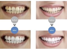エムラボ 表参道店(M LABO)