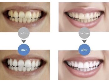 エムラボ 表参道店(M LABO)