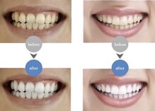 エムラボ 表参道店(M LABO)