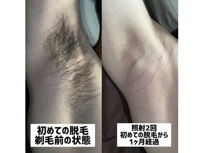 ミスターアンドミス脱毛専門店 難波店(Mr.&Ms.脱毛専門店)の写真