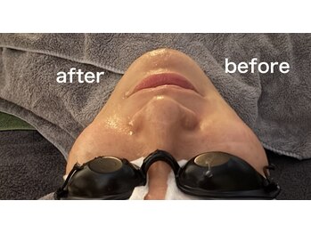 アンサー(ANSWER)/